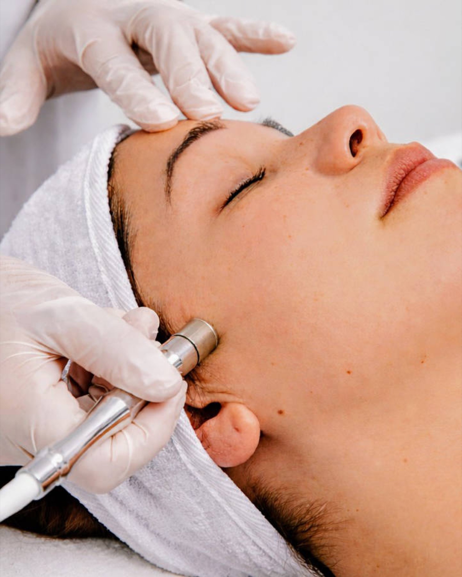 Mikrodermabrasion